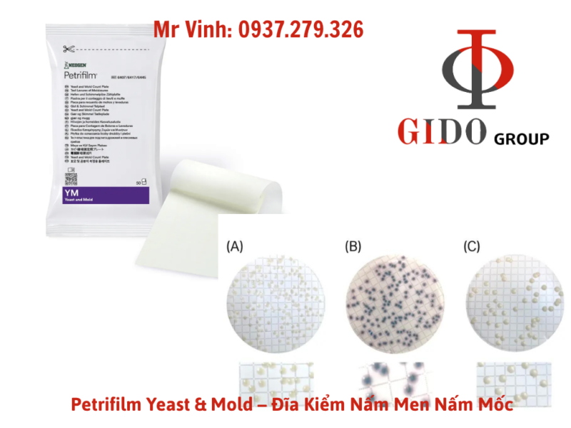 Phân biệt khuẩn lạc nấm men và nấm mốc